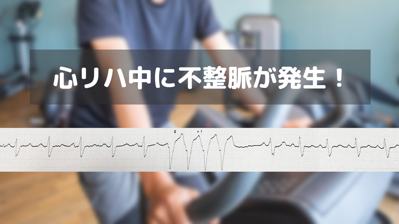 心リハでエアロバイク中「不整脈」になった/3月は脈の日と心房細動週間